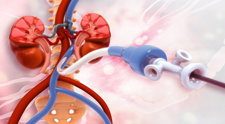 peripheral artery disease treatment from Maryland Vascular Specialists